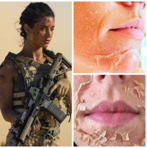 Chemical peel Facial Somerset West